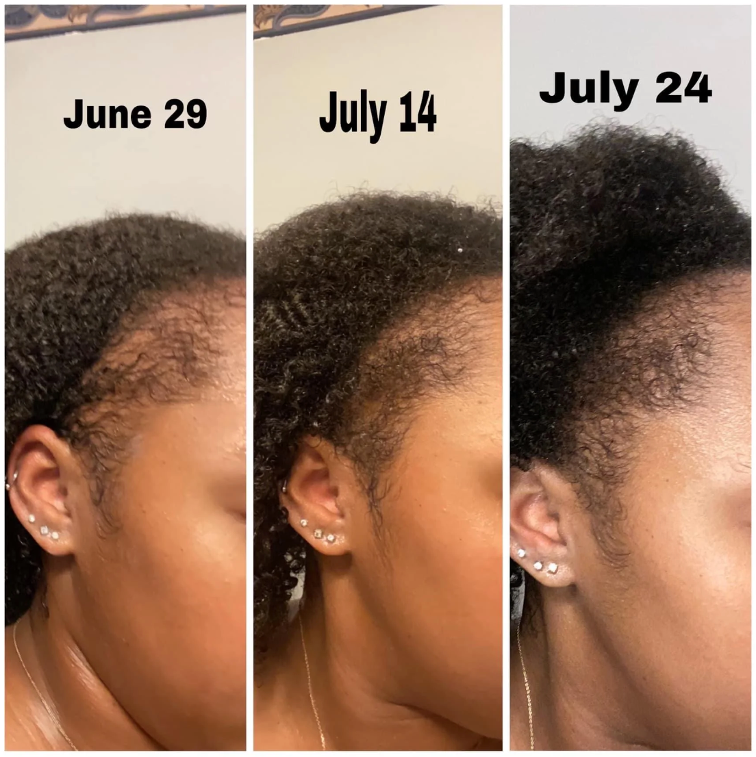 The Growth Bundle (3 Bottles)